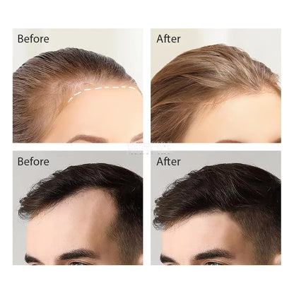 Bio 120Pin Derma Roller Stamp Adjust Needle Derma Microneedle Pen for Beard Hair Growth Microneedling Dermaroller Skin Care