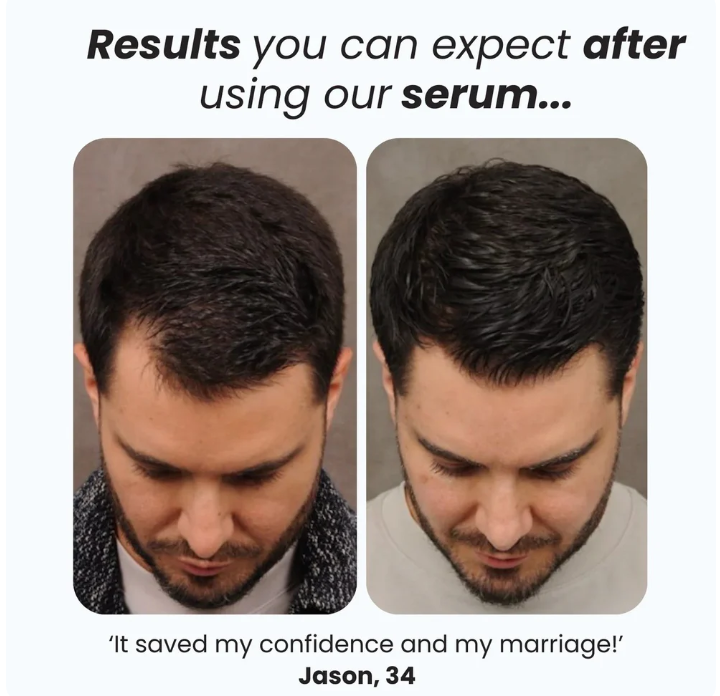Hair Growth Serum Roll-On