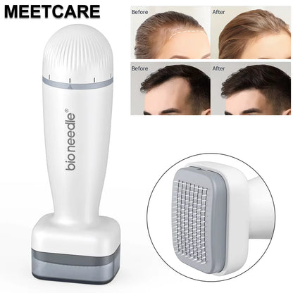 Bio 120Pin Derma Roller Stamp Adjust Needle Derma Microneedle Pen for Beard Hair Growth Microneedling Dermaroller Skin Care