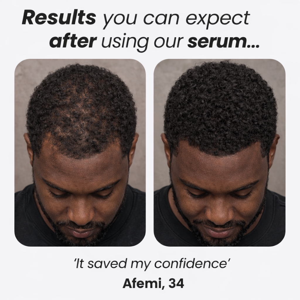 Hair Growth Serum Roll-On